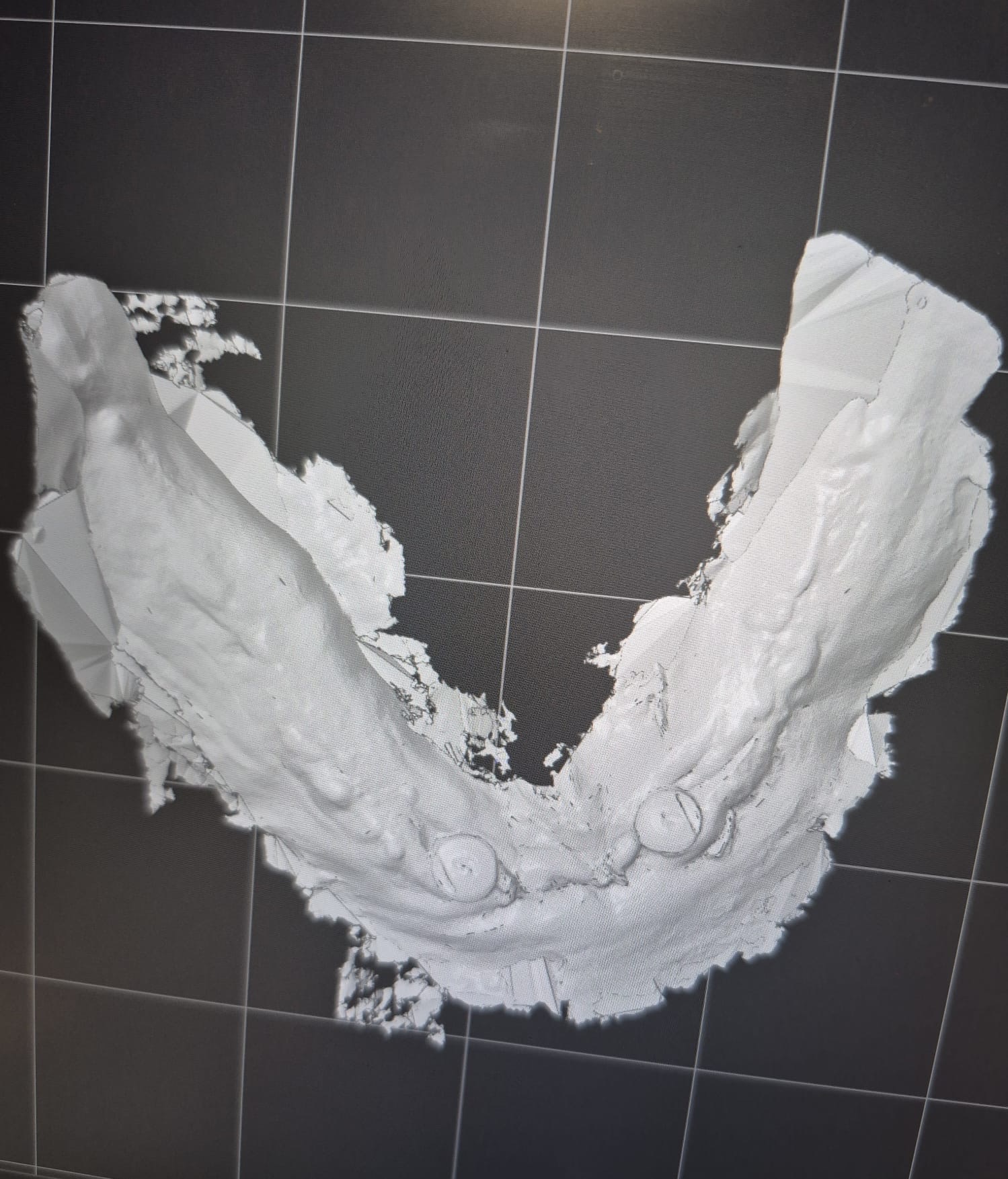 Digital dentistry workflow